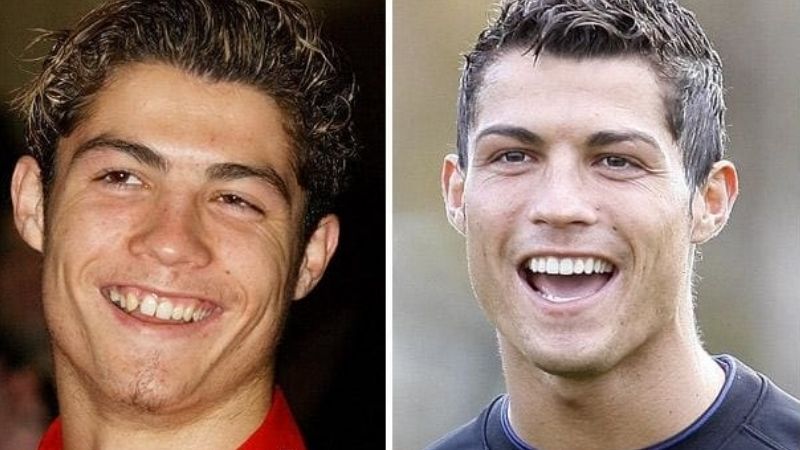 Hình ảnh Ronaldo trước khi phẫu thuật thẩm mỹ
