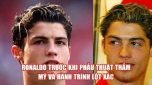 Ronaldo Trước Khi Phẫu Thuật Thẩm Mỹ Và Hành Trình Lột Xác
