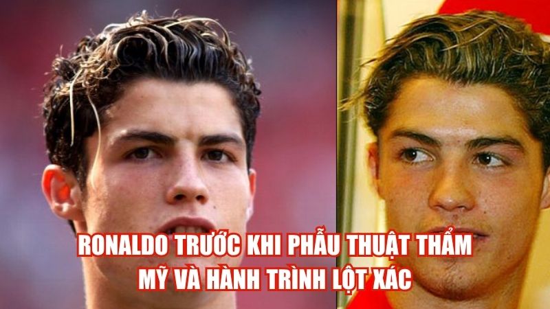 Ronaldo Trước Khi Phẫu Thuật Thẩm Mỹ Và Hành Trình Lột Xác