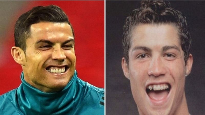 Ronaldo và chuẩn mực cái đẹp trong bóng đá hiện đại